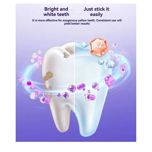 Advanced Purple Teeth Whitening Strips – Non-Sensitive Formula